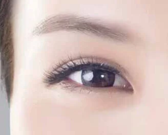 Close-up of a woman's eye and brow for PDO thread lifting in London